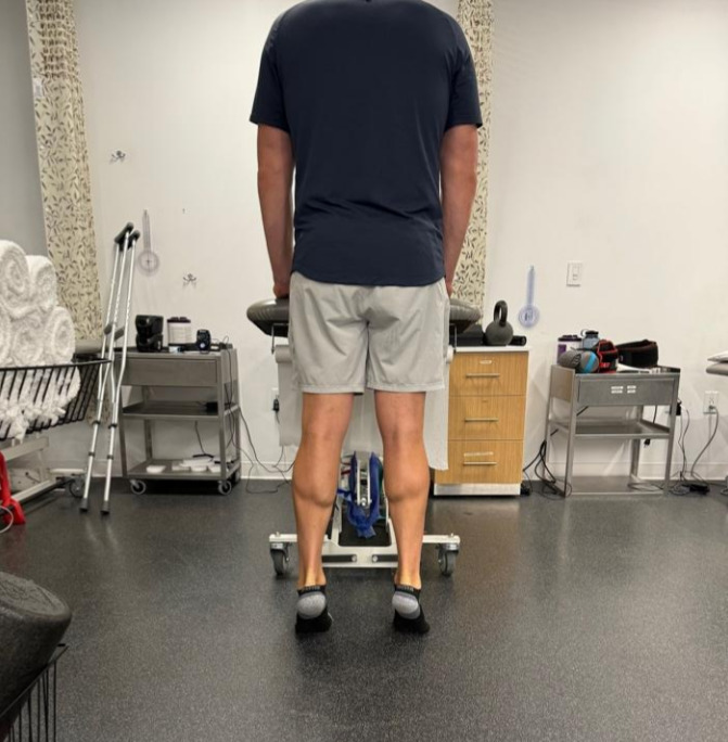Standing bilateral heel rise